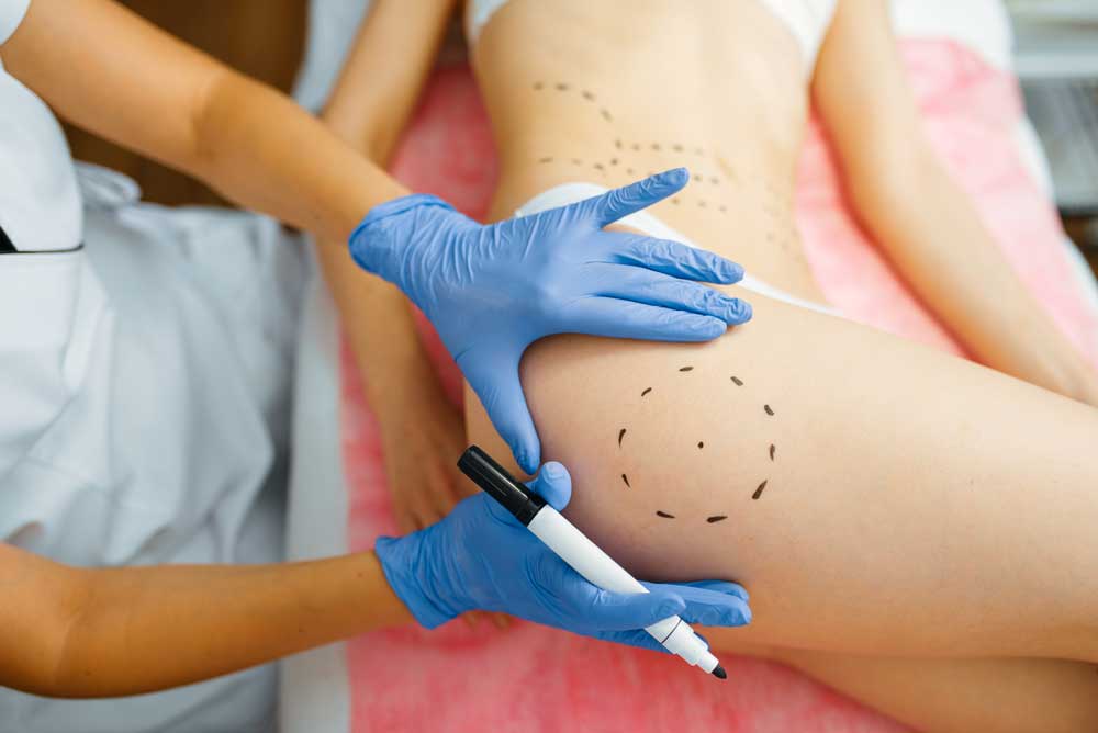 cosmetician with marker puts dotted lines on body 2024 11 28 12 12 39 utc | 2025